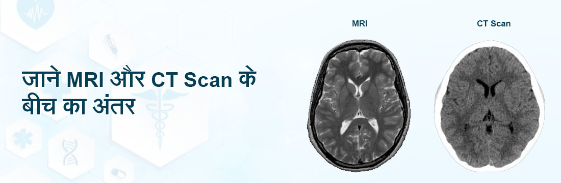 जाने MRI और CT Scan के बीच का अंतर